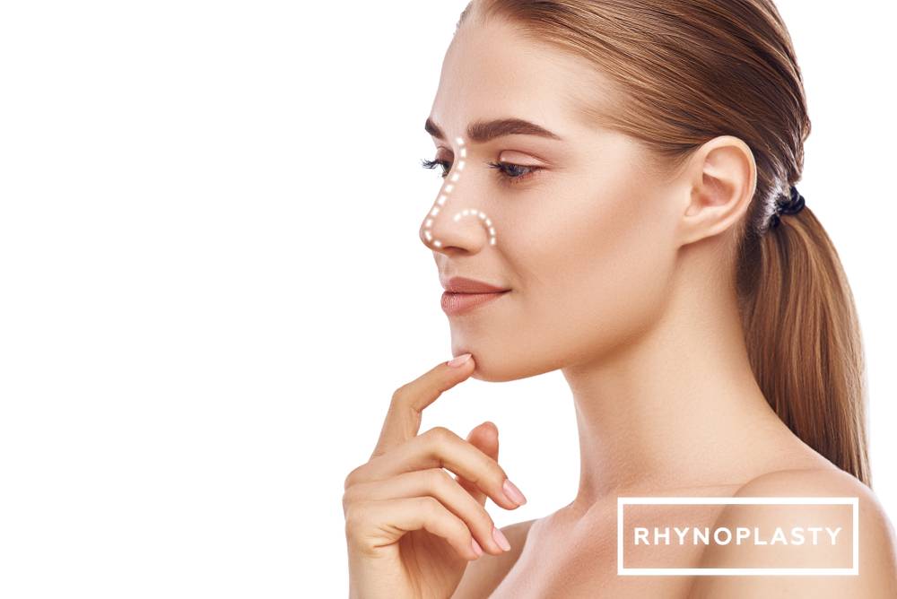 What Is Rhinoplasty Dr Frati Cosmetic Surgery
