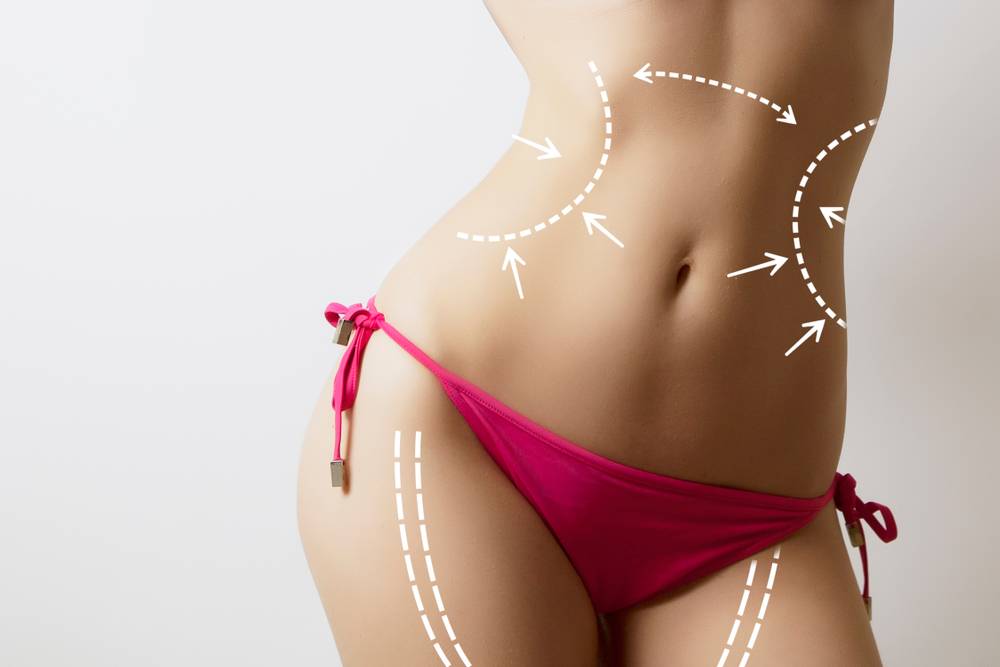 Who is a Great Candidate for Liposuction? Dr Frati Cosmetic Surgery