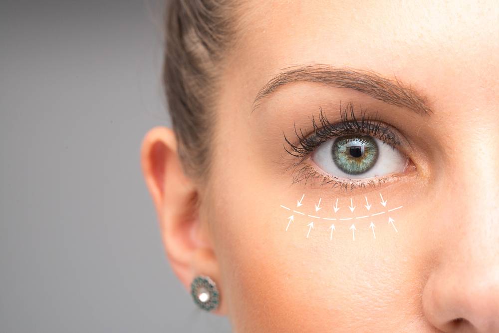 What is a Brow Lift? Dr Frati Cosmetic Surgery