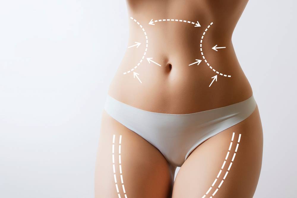 What is Vaser Liposuction? Dr Frati Cosmetic Surgery