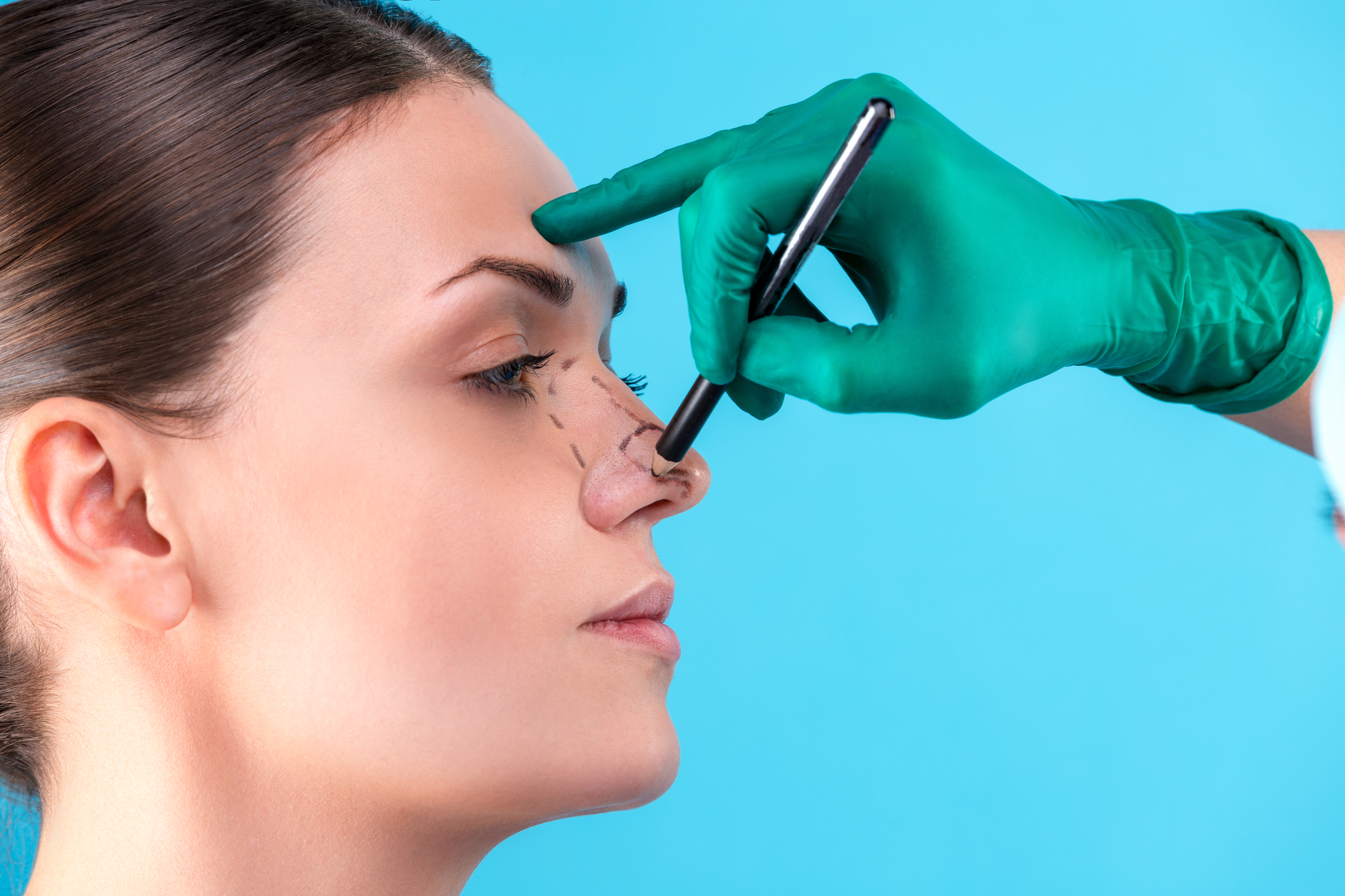 Recovery Time After Rhinoplasty recovery period